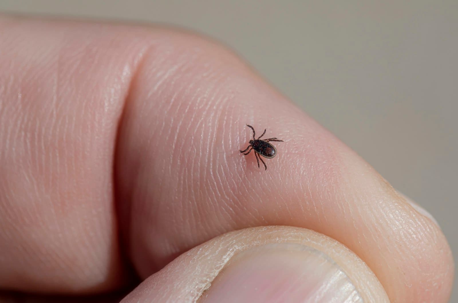 Carrapato sobre dedo humano em macro